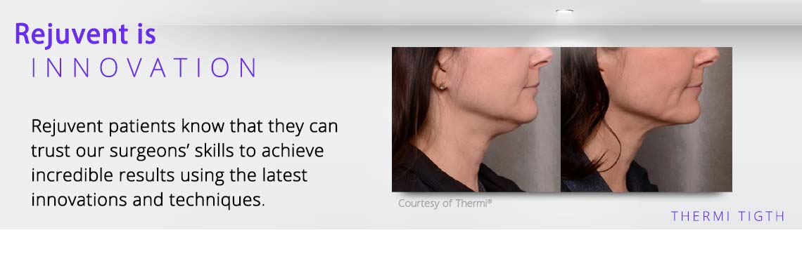 ThermiRF innovation
