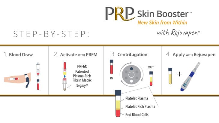 Step by step PRP