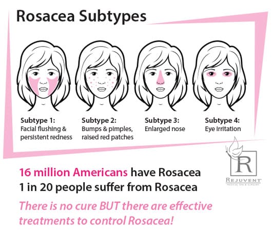 Rosacea subtypes