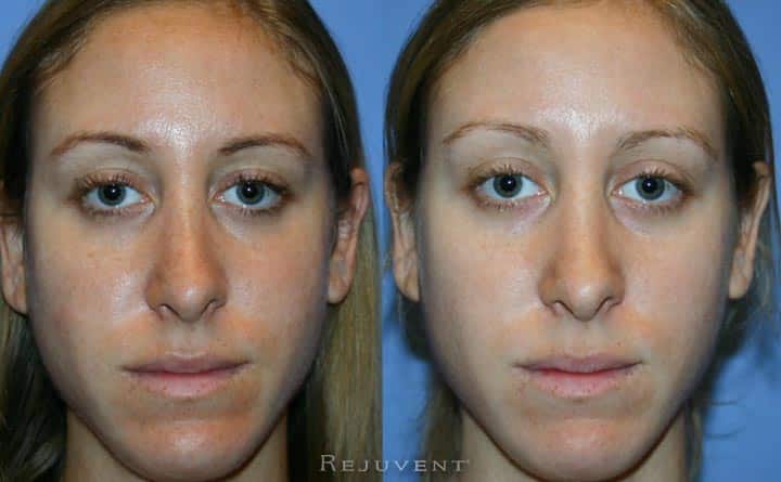 Skin of 30s patient