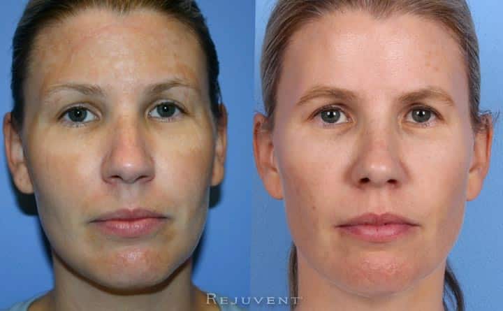 30s skincare results