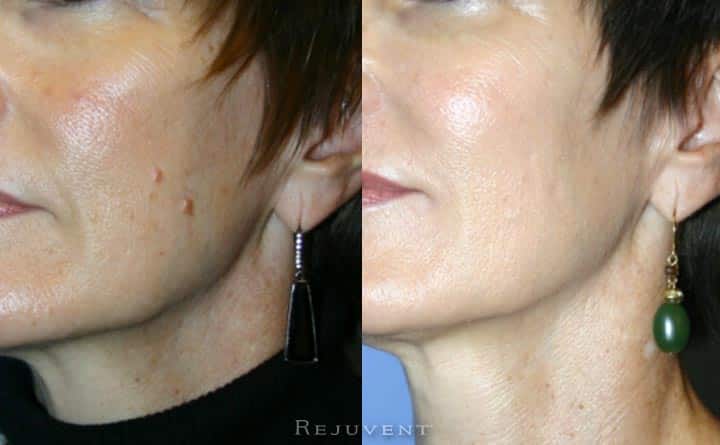 Aging skin results after using medical grade skin care