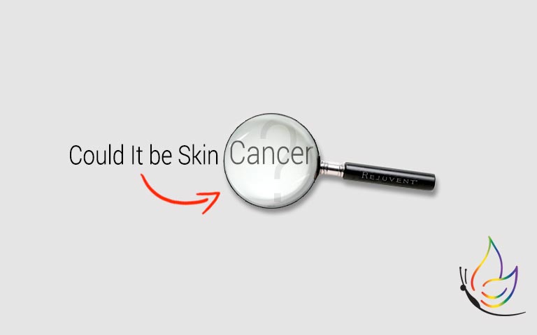Could it be skin cancer