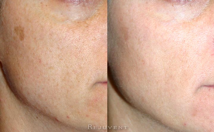 Better skin texture and less skin dryness
