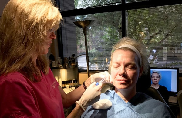Dr. Kelly Bomer injecting filler on patient
